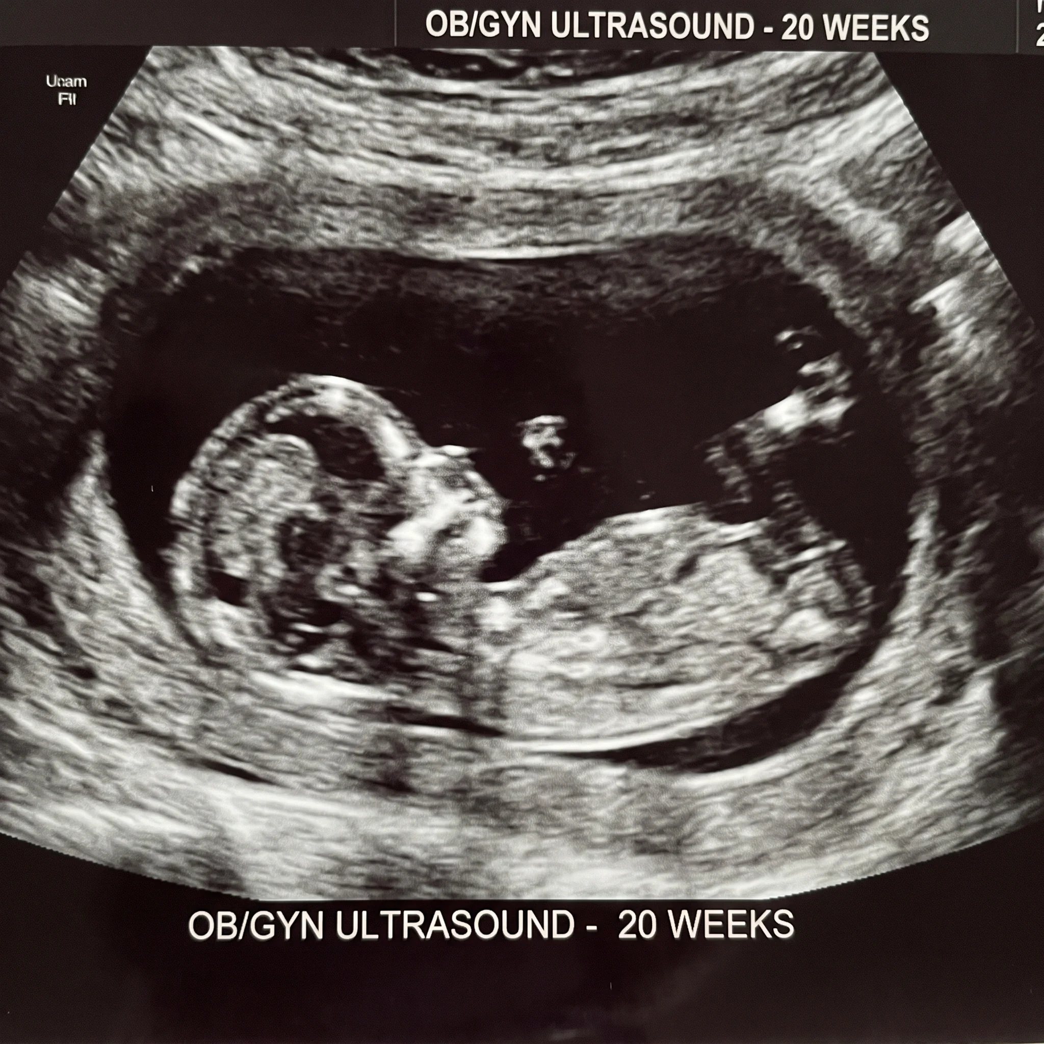 Four illustrations of fetal development stages inside the womb, showing embryo, early fetus, later fetus, and very late fetal stage.